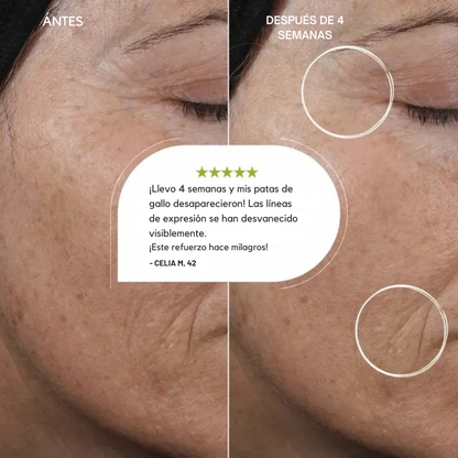 Booster Antiedad de Retinal – Piel Firme y Luminosa